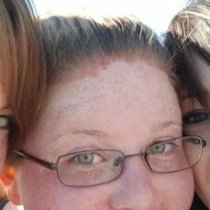Psoriasis June 2011