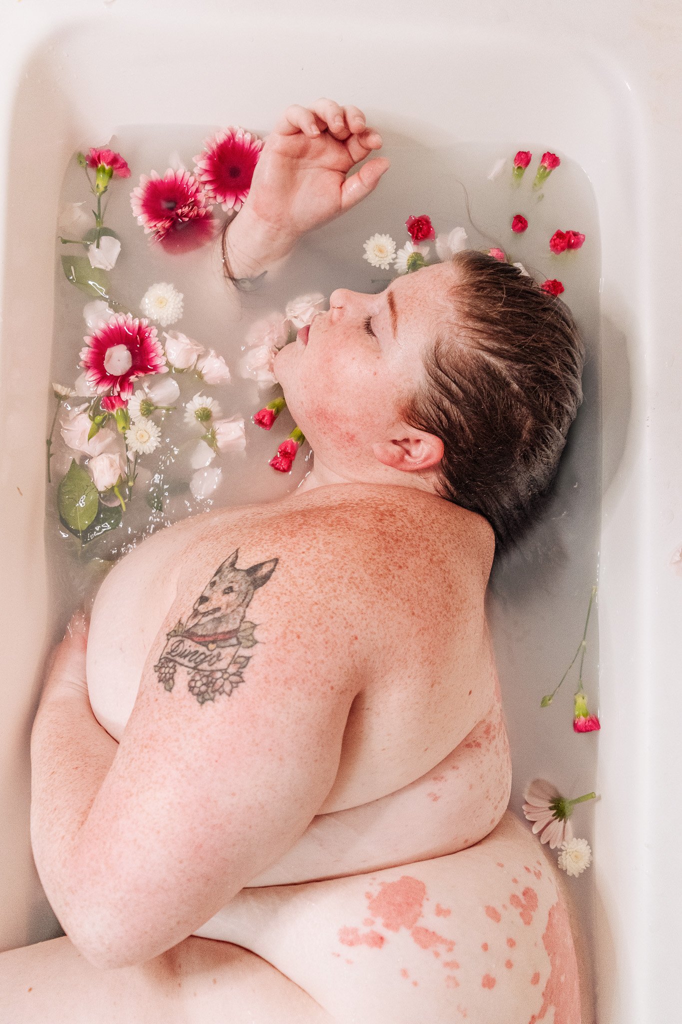 Plus size woman in a bathtub showing the plaque psoriasis on her back and butt