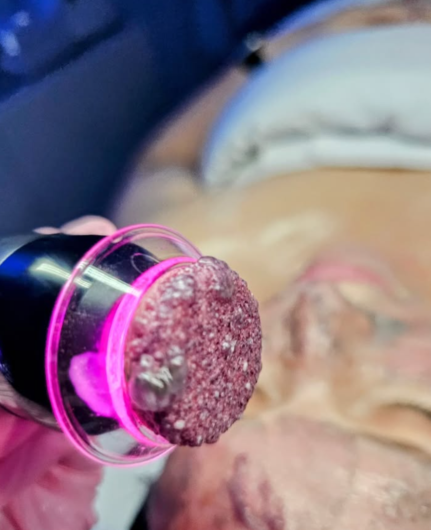 ✨ Glo2 vs HydraFacial: What’s the Difference (and Why I Chose Geneo Glo2 at Dearglow)