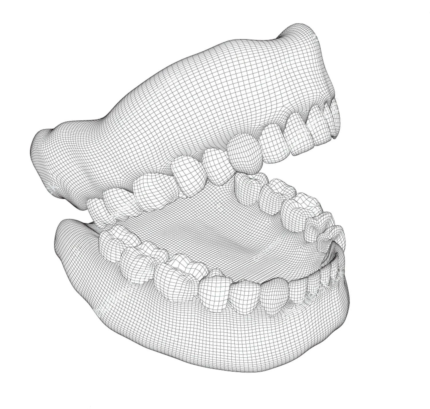 Case Planning & Smile Redesign