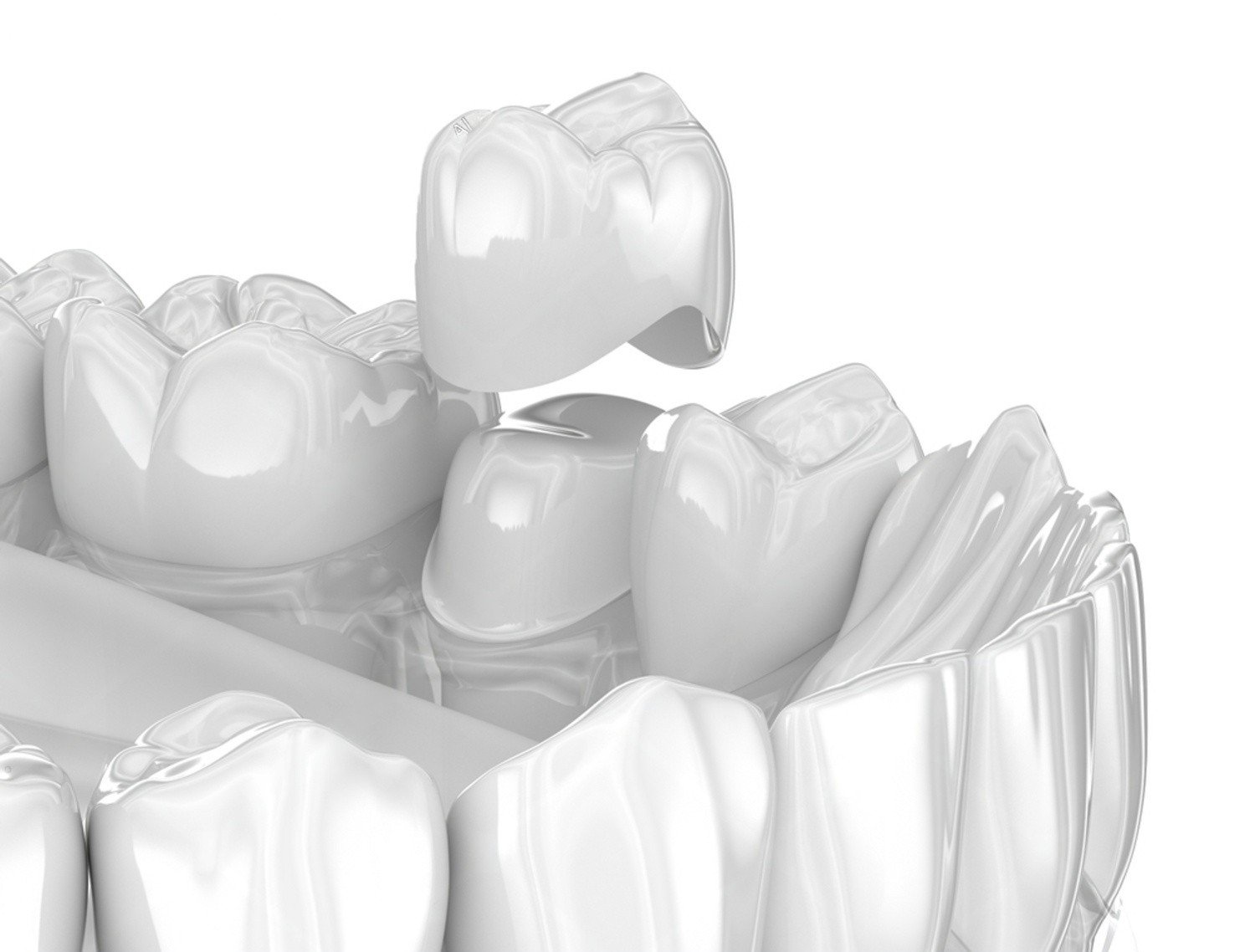Crowns