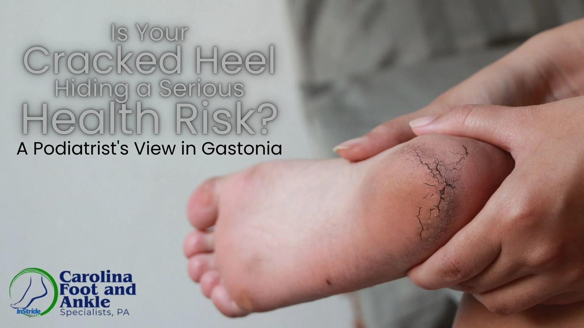 Is Your Cracked Heel Hiding a Serious Health Risk? A Podiatrist's View in Gastonia