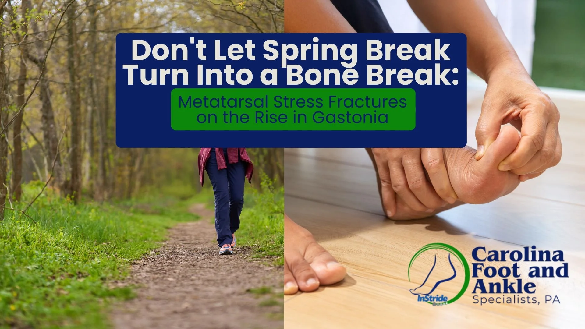 Don't Let Spring Break Turn Into a Bone Break: Metatarsal Stress Fractures on the Rise in Gastonia