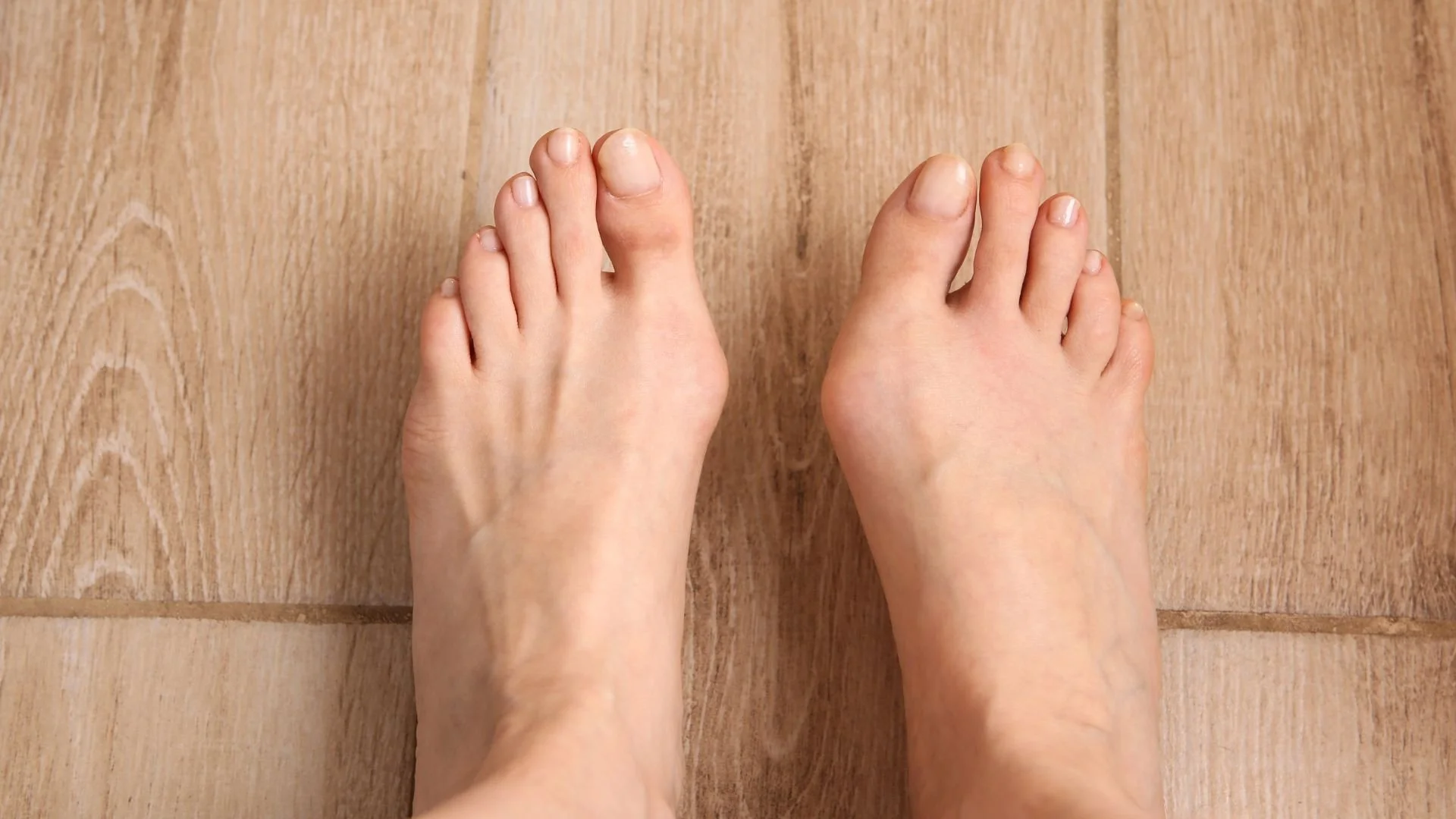 photo of a pair of misaligned feet