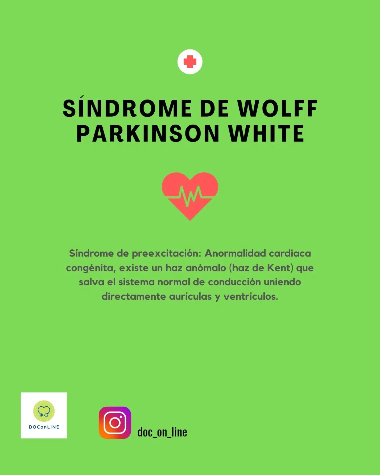 S&iacute;ndrome de Wolff-Parkinson-White

📌Aprende f&aacute;cil

#sindromedewolffparkinsonwhite #ecg #cardiologia #s&iacute;ndromedepreexcitaci&oacute;n #prcorto