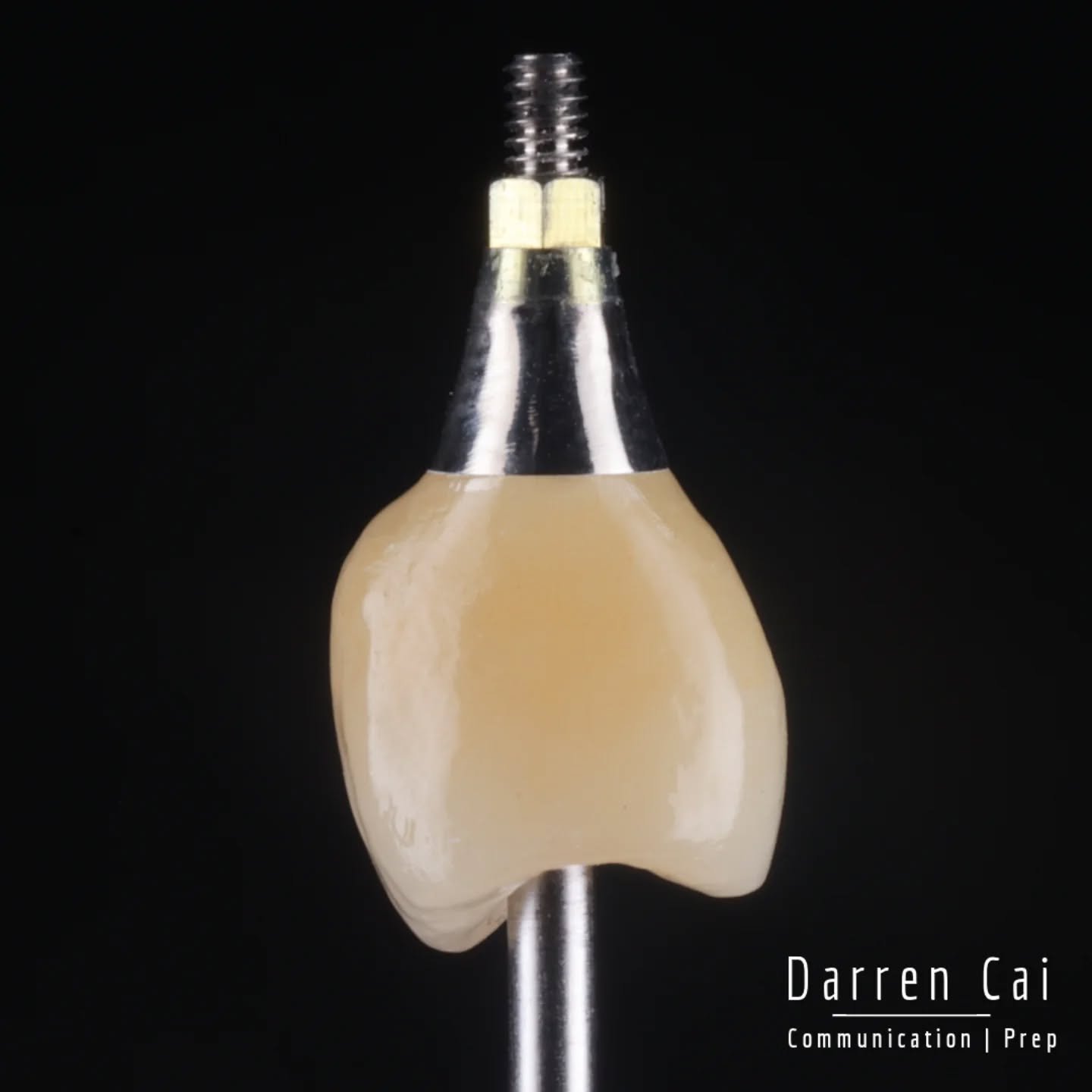 This patient was the quiet, stoic type. 

But as soon as the mirror came up he smiled and said:

"Oh&hellip; would you look at that - I have my tooth back."

24 came in after a failed RCT and a root fracture - deemed hopeless by the endodon