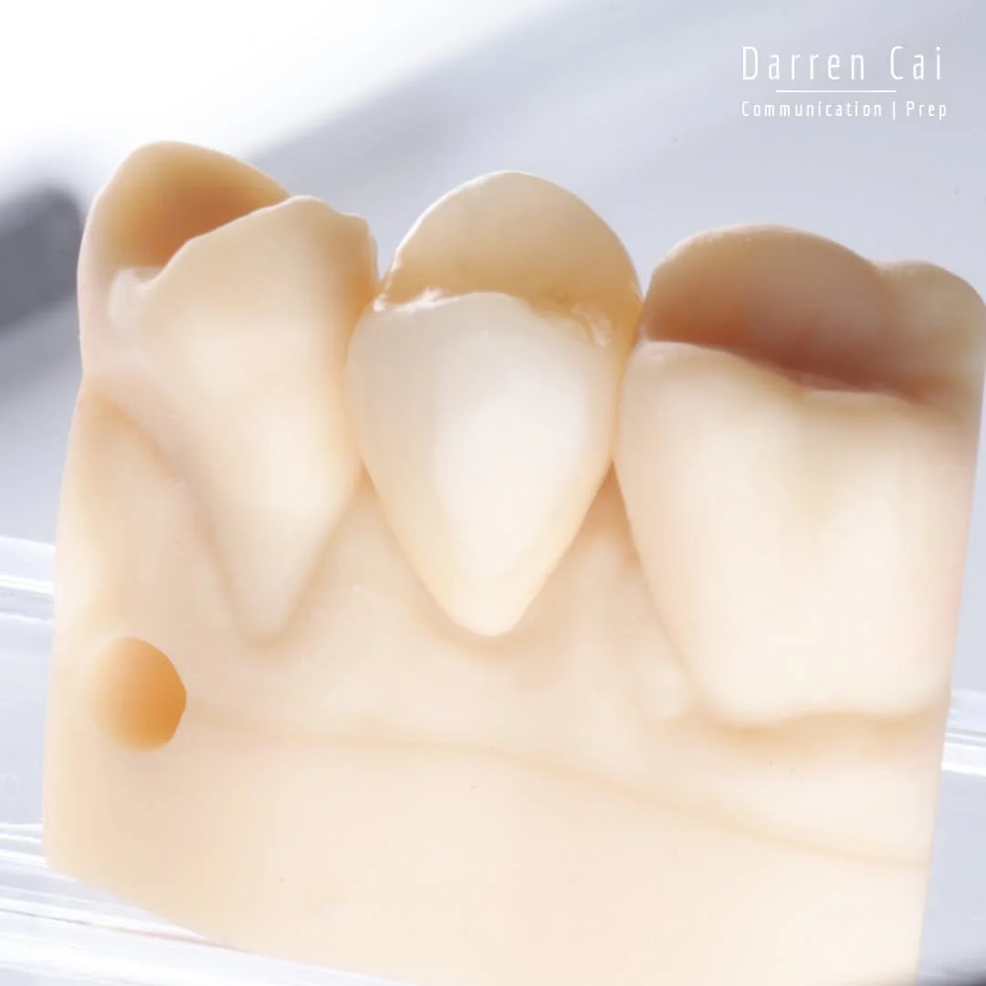 She came in mid-travel around Australia, managing a buccal abscess on 15 - given antibiotics in another state just to get by.

She wanted extraction&hellip; just so she didn&rsquo;t have to think about it anymore.

We slowed things down, talked it th