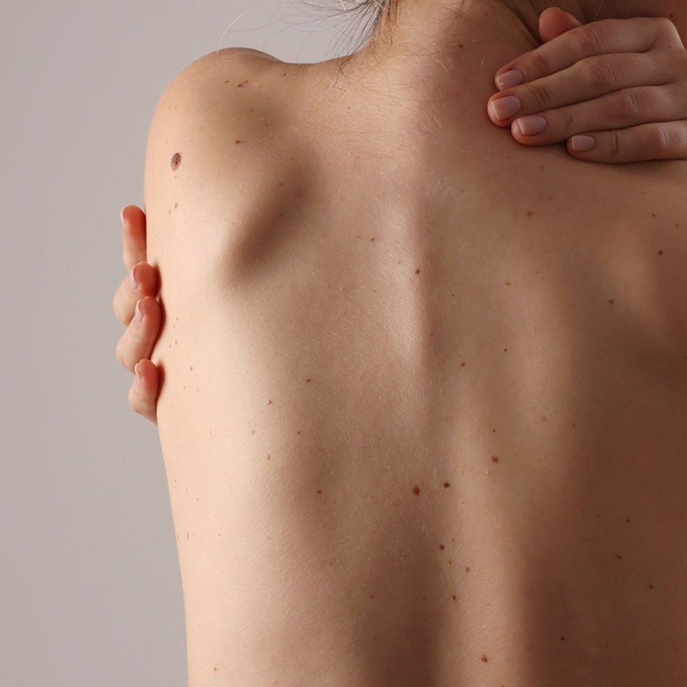 La somatisation : c’est quoi ? Comment en guérir ? 