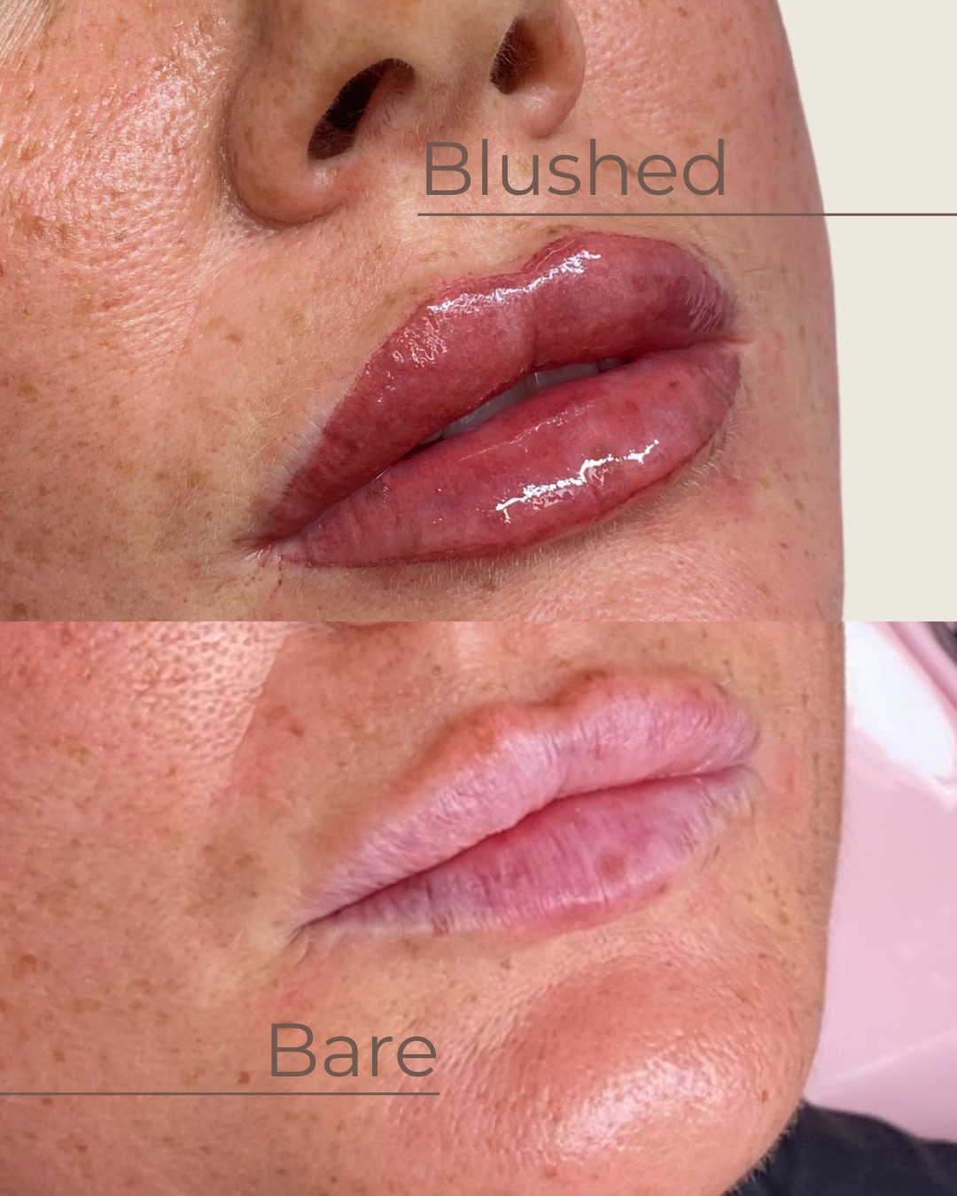 Comparison of lips before and after cosmetic enhancement, with the top image showing swollen, glossy lips labeled 'Blushed,' and the bottom image showing natural lips labeled 'Bare'.