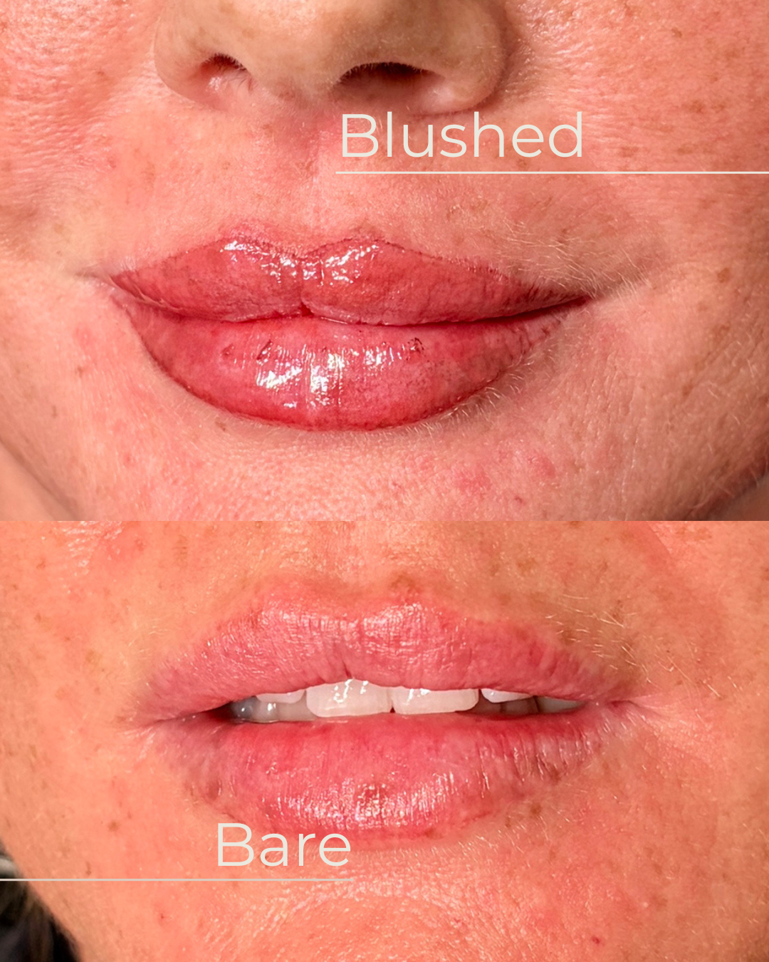 Comparison image showing lips with gloss on the upper image and natural healed lip blush without gloss on the lower image.