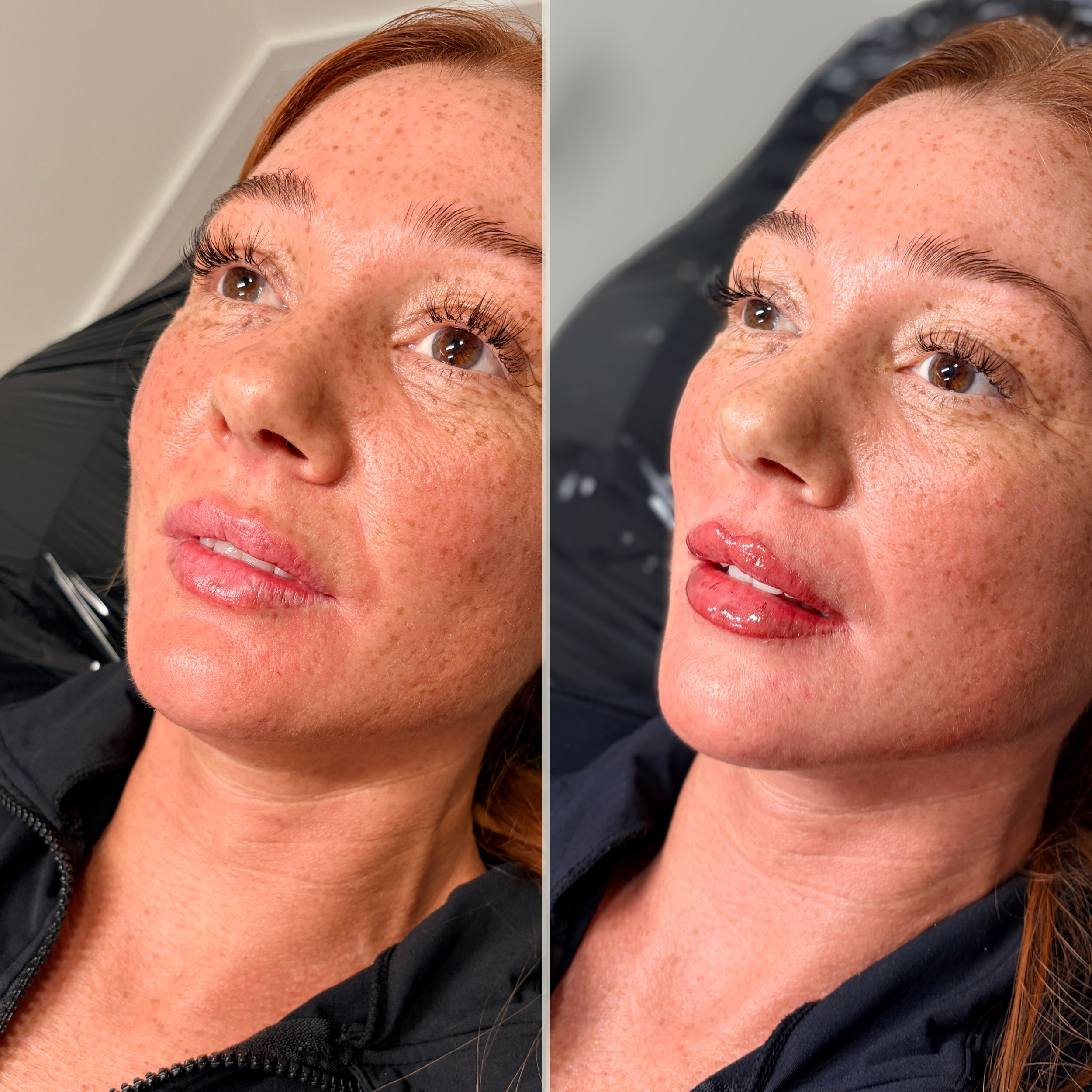 before&after story (Insta) (3000 x 3000 px)-2.png