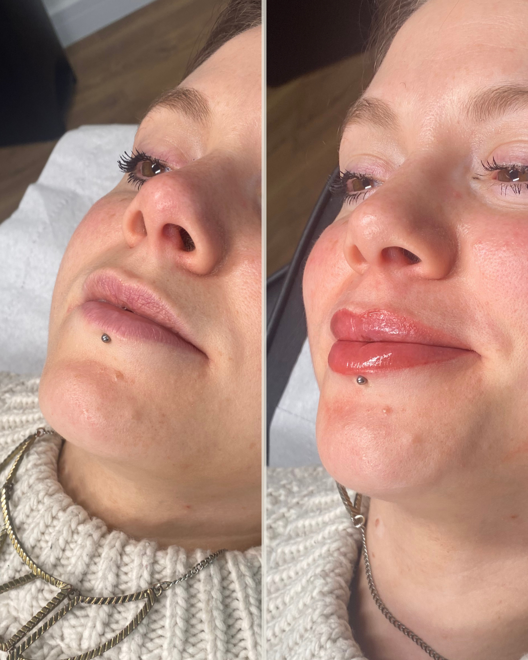 before&after story (Insta)-4.png