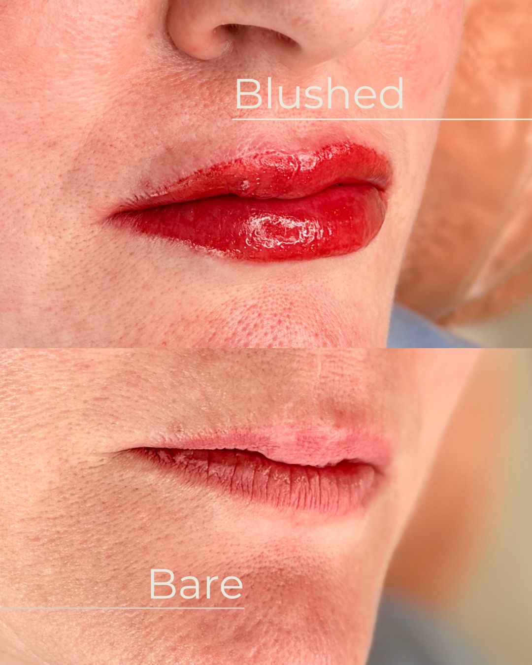 Close-up of lips, showing a comparison between lip blush and bare lips without makeup that show scarring