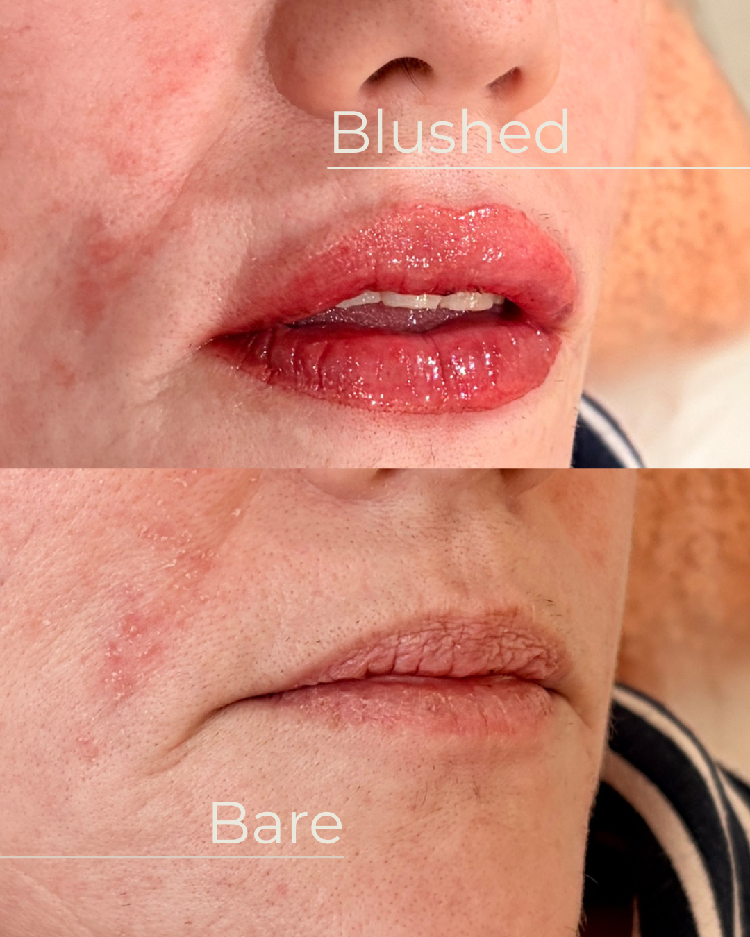 Close-up of the same person's lips: one with shiny, pinkish lipstick and the other bare, showing natural texture and color.