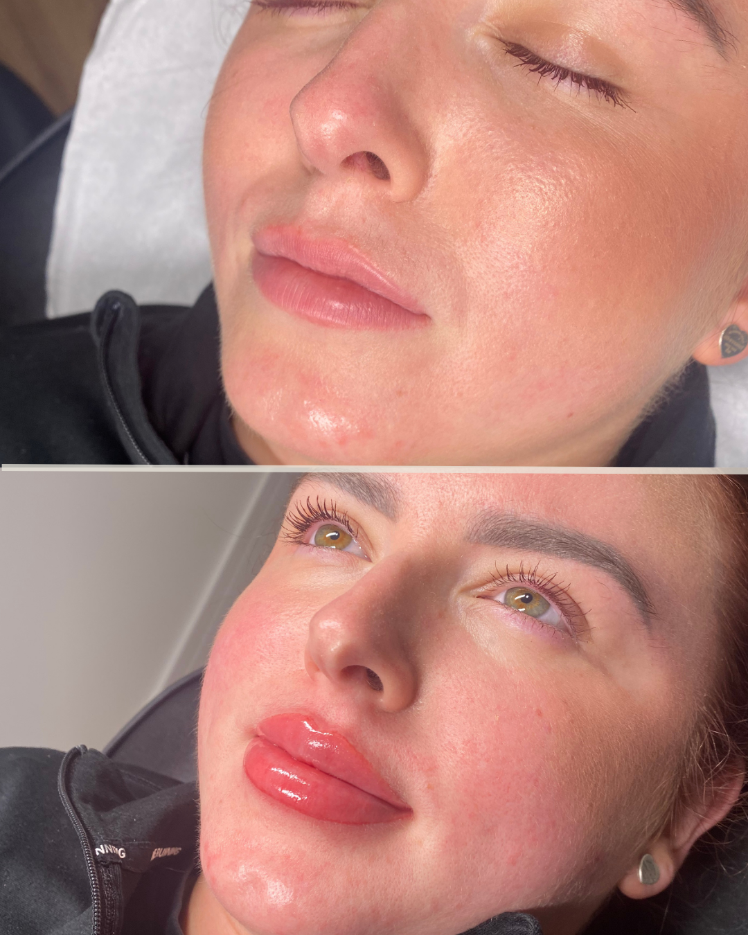 before&after story (Insta)-2.png