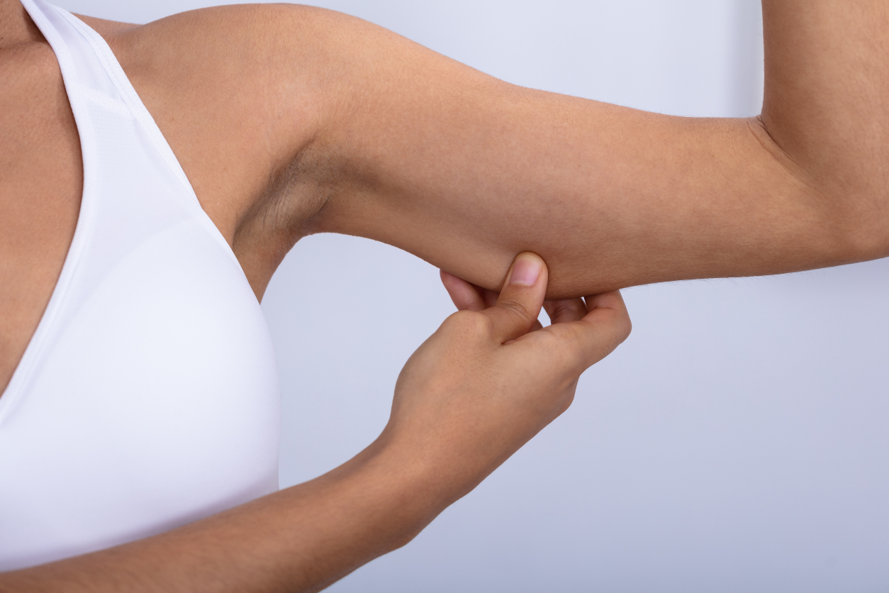 Arm Skin Tightening Treatments: Why Morpheus8 Is a Top Choice