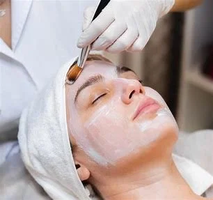 5 sessions chemical peel (save $50)