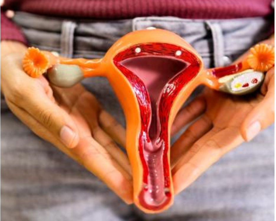 You Need To Know: Ovarian Cancer Campaign 
