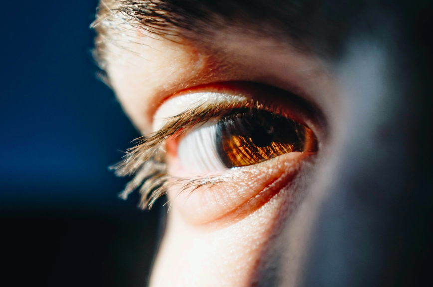 How Eyelid Hygiene Prevents Dry Eye &amp; Blepharitis
