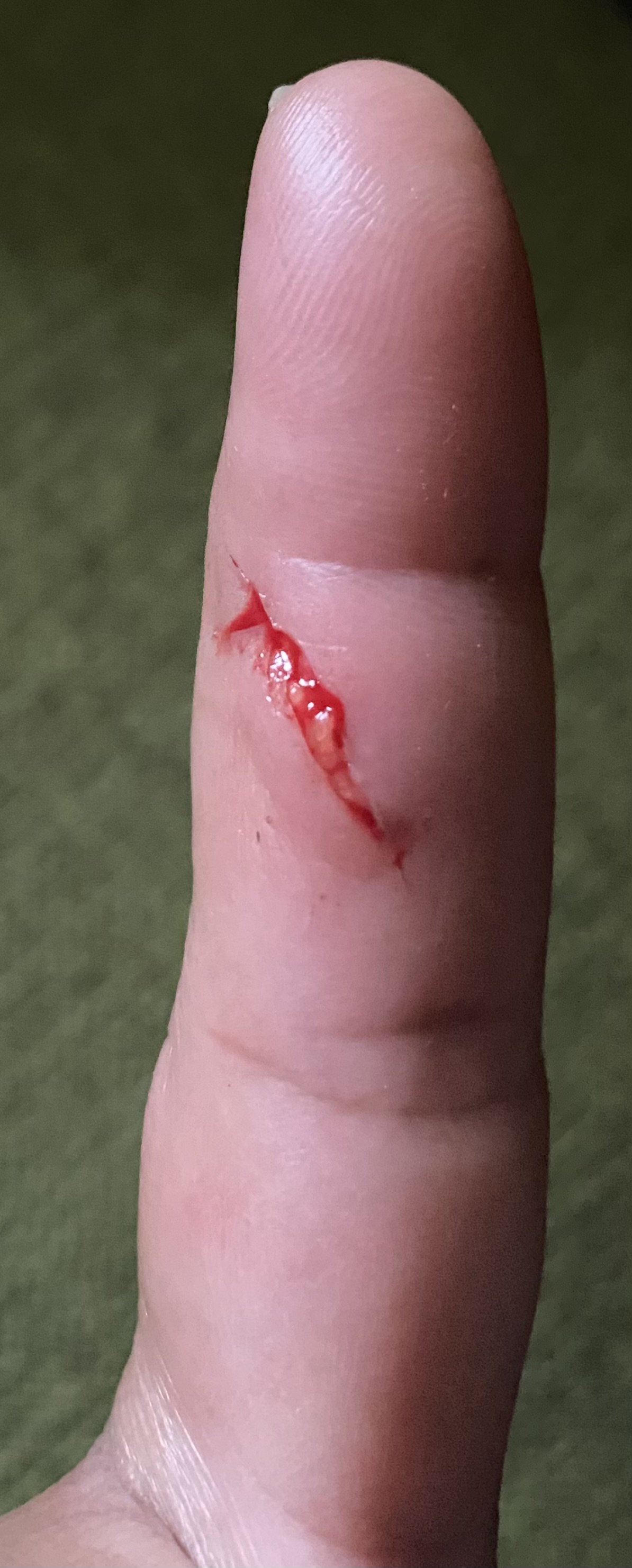 AromaHerbal Wound Care