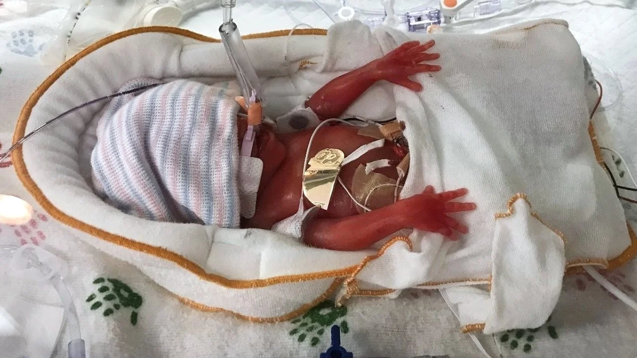 New born receiving care