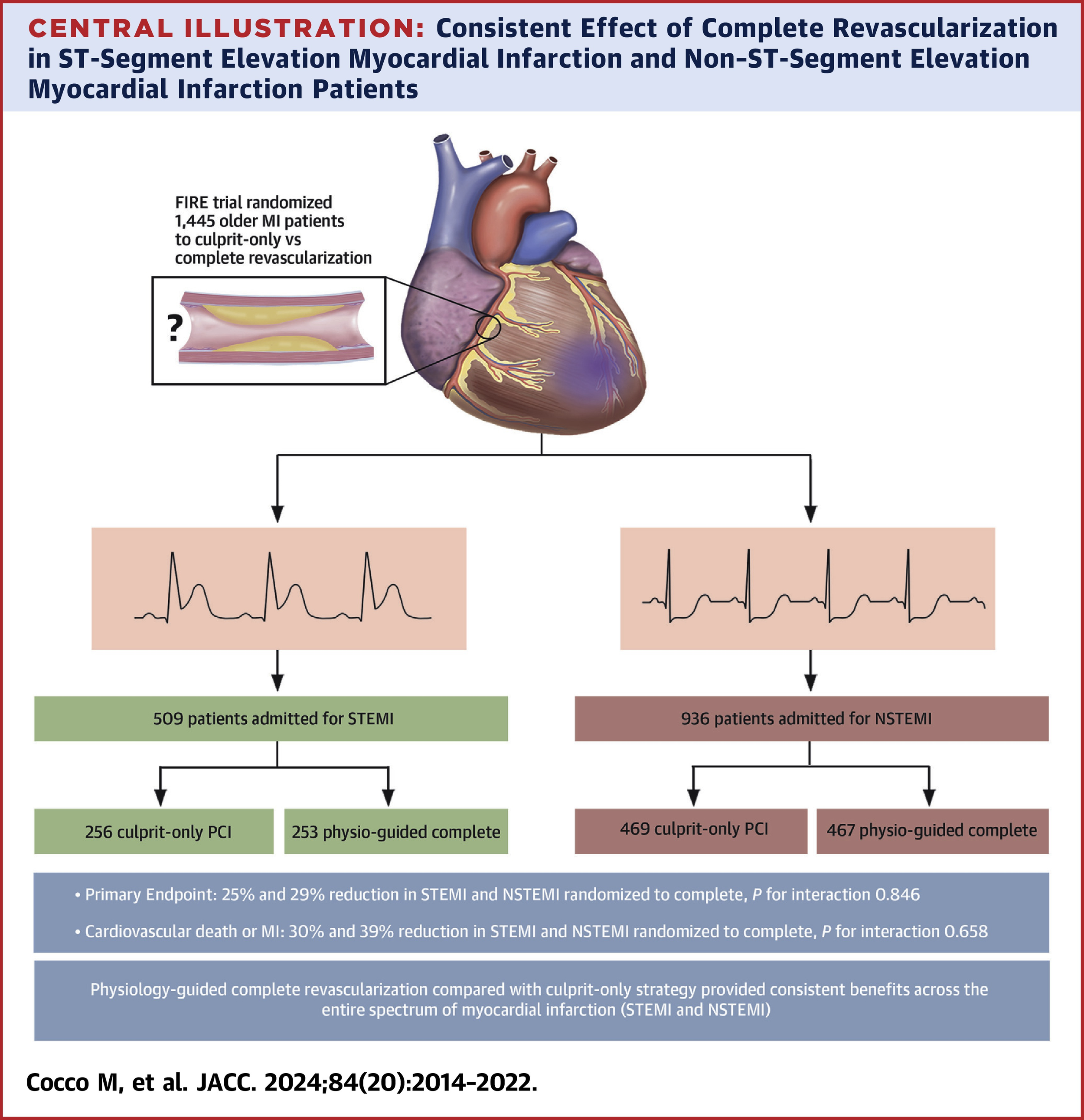 April 2024: FFR-Guided Complete or Culprit-Only PCI in Patients with Myocardial Infarction
