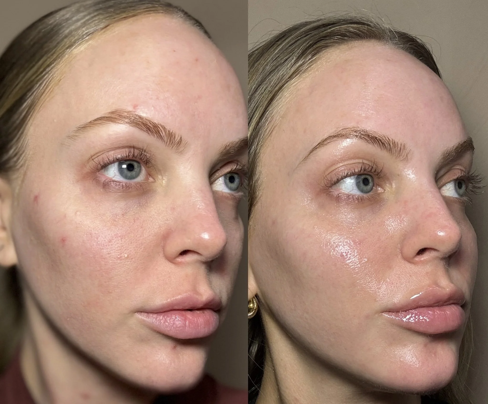 Side-by-side comparison of a woman's face before and after skincare or makeup application, showing improved skin texture and glow on the right.