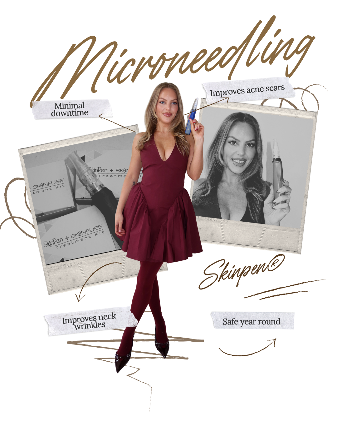 A woman in a burgundy dress holding a skincare device, with promotional posters for a skincare treatment kit that claims to improve acne scars, neck wrinkles, and provide minimal downtime, and is safe year-round.