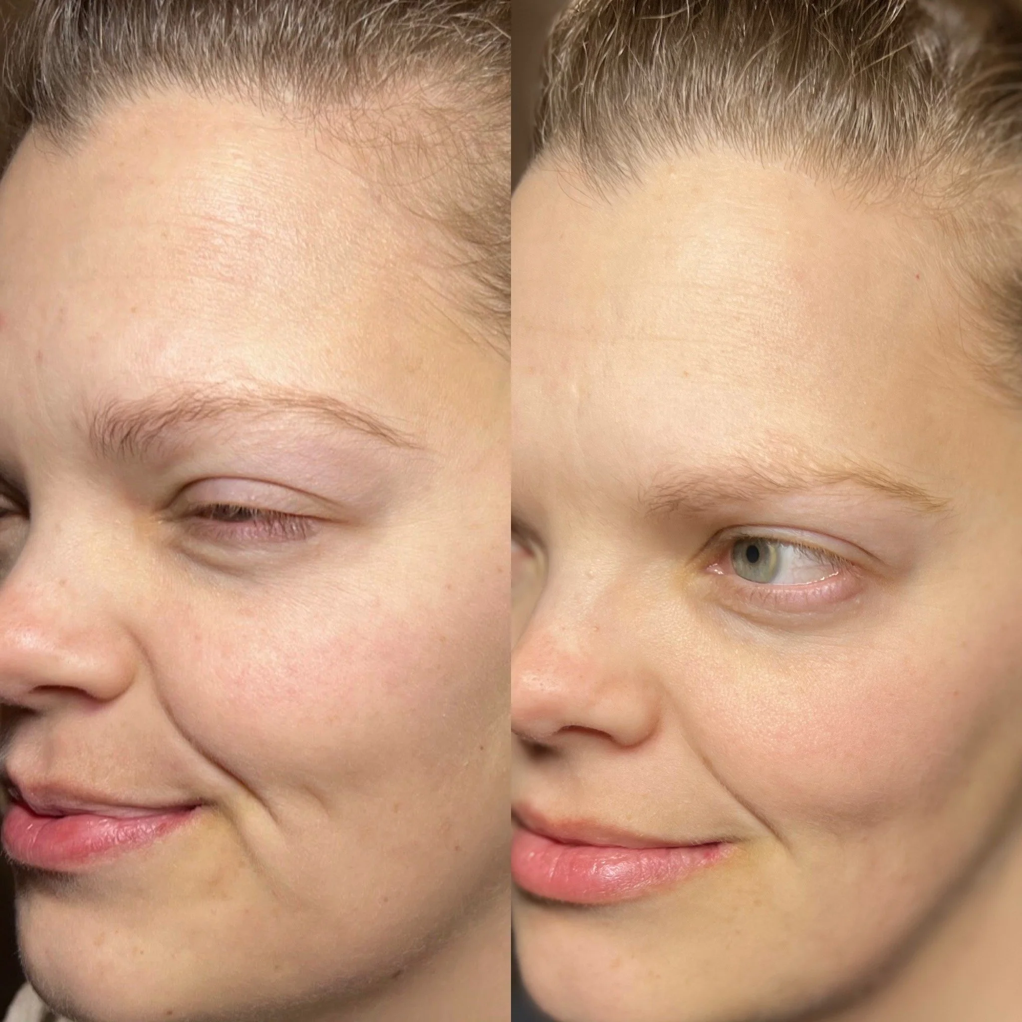 Comparison of a woman's face before and after skincare or makeup application, showing smoother and clearer skin on the right.