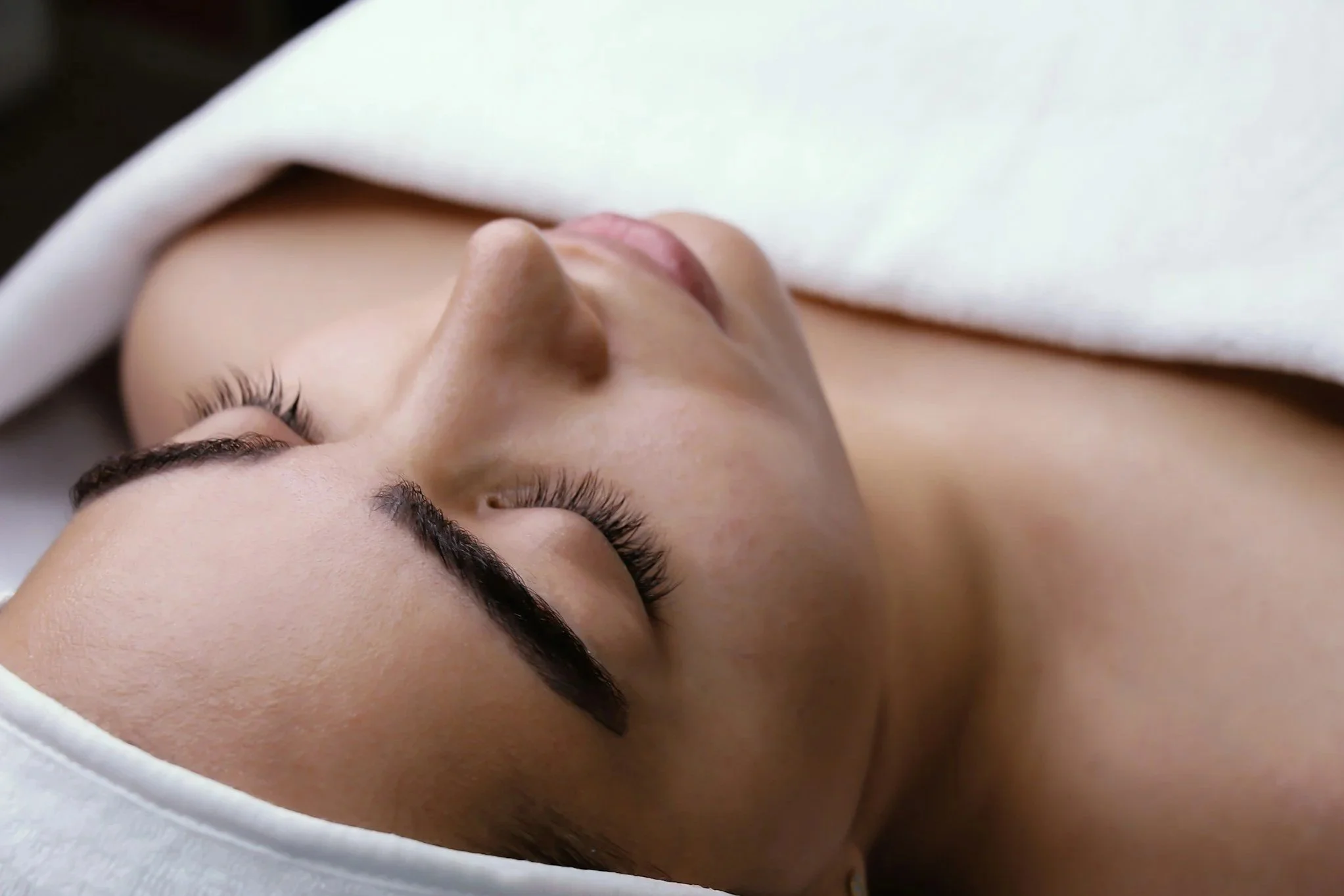 XERF radiofrequency skin-tightening treatment at Goldhaus Wellness in NYC