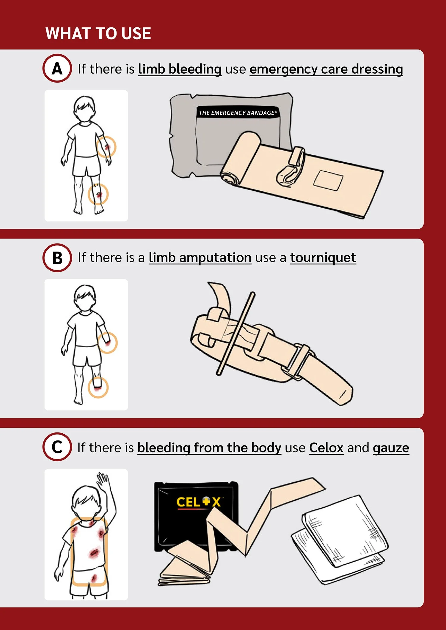 Bleed control pack action card