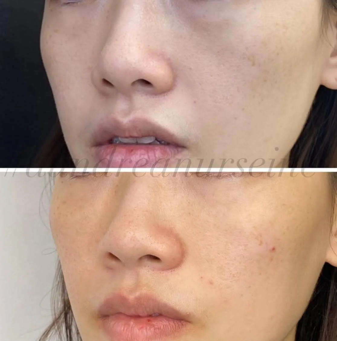 A&M-Clinical-Beauty-filler-eye