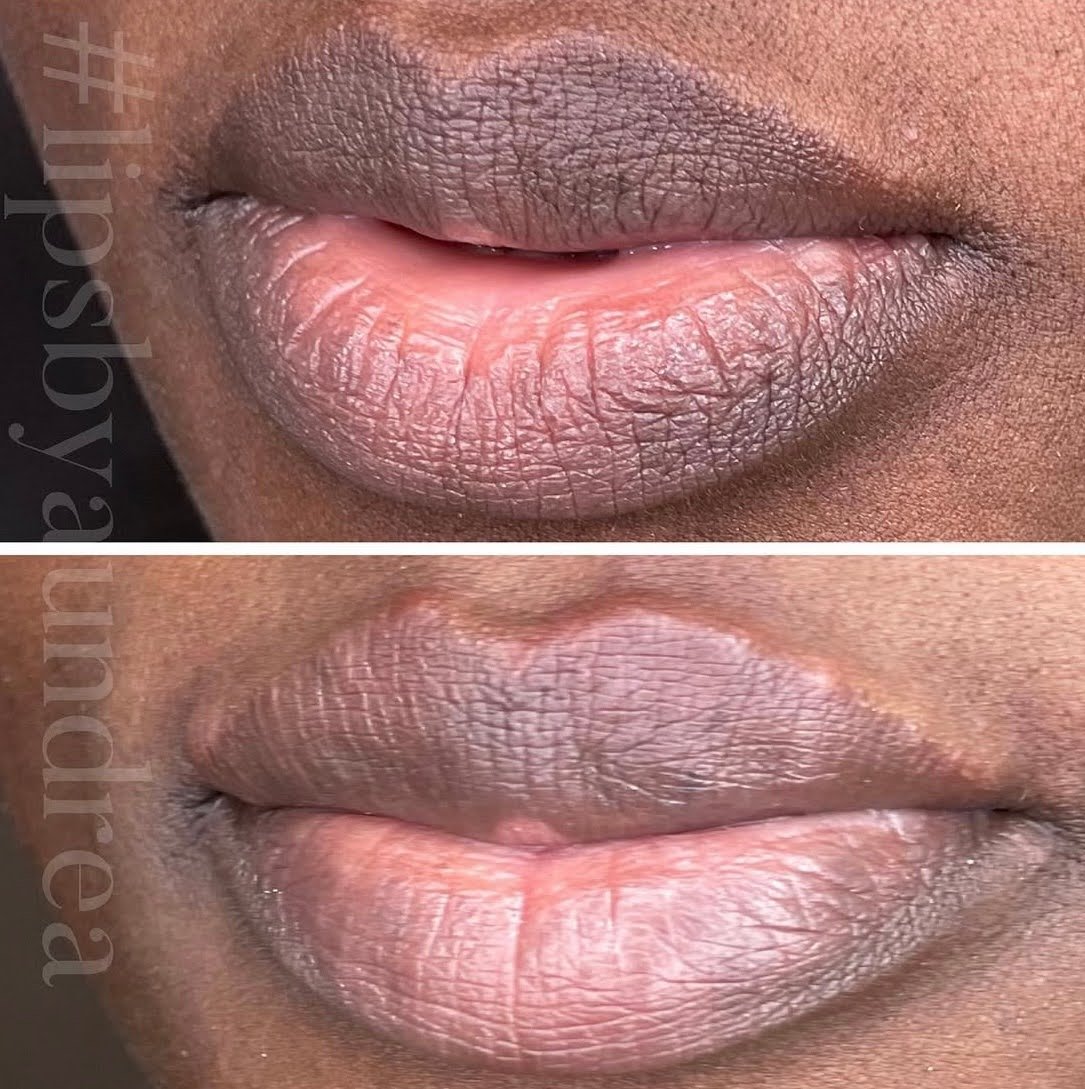 A&M-Clinical-Beauty-filler-eye