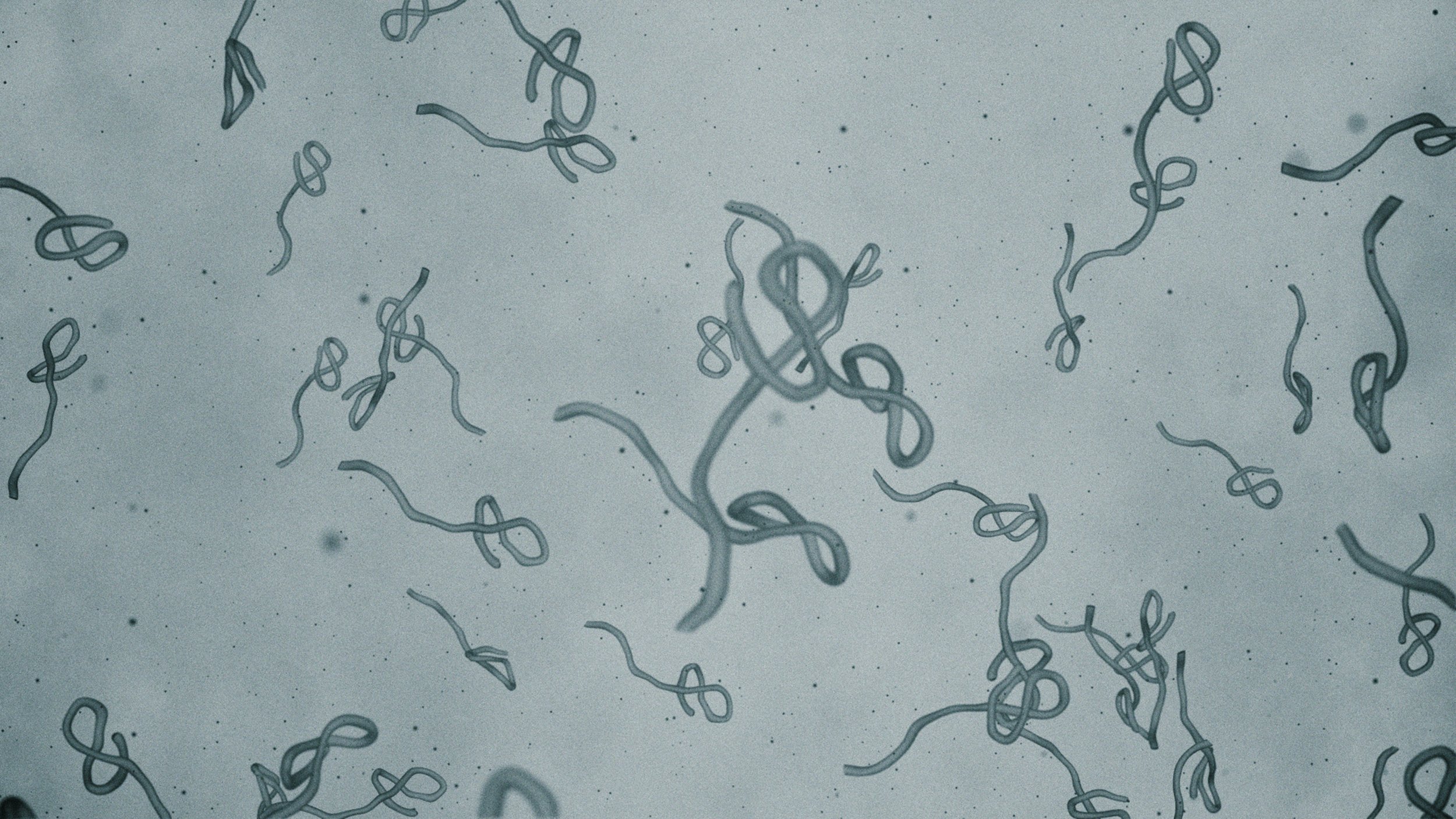 Microscopic View of Infectious Ebola Virus Cells stock photo