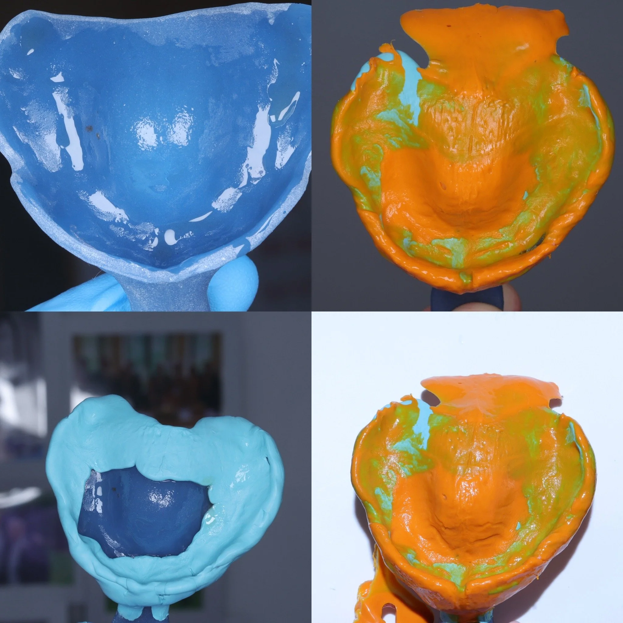 Master impression with silicone