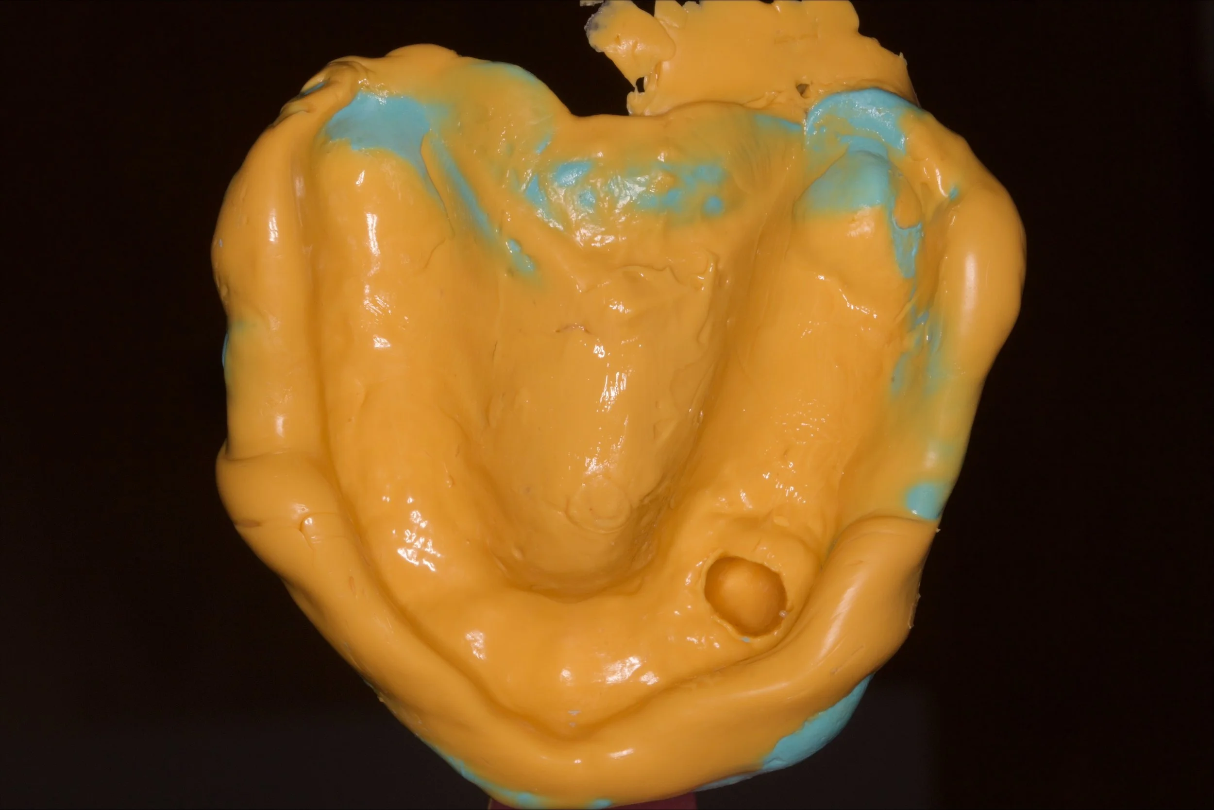 Master impression using silicone