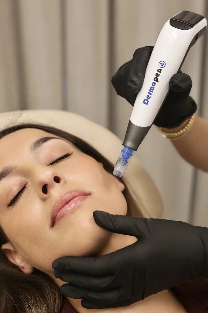 Medspa in Columbus, OH 43215 l Microneedling Near Me