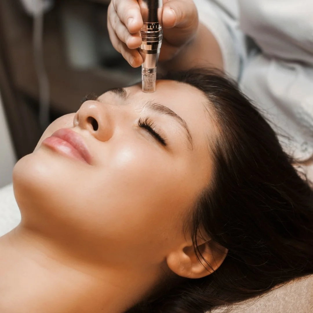 Medspa in Columbus, OH 43215 l Microneedling Near Me