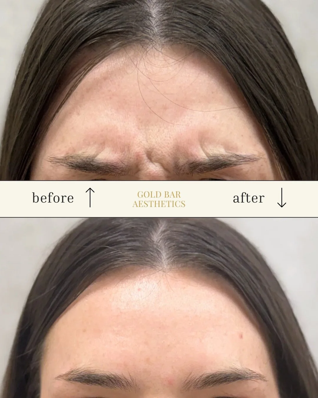 Medspa in Columbus, OH 43215 l Botox Near Me