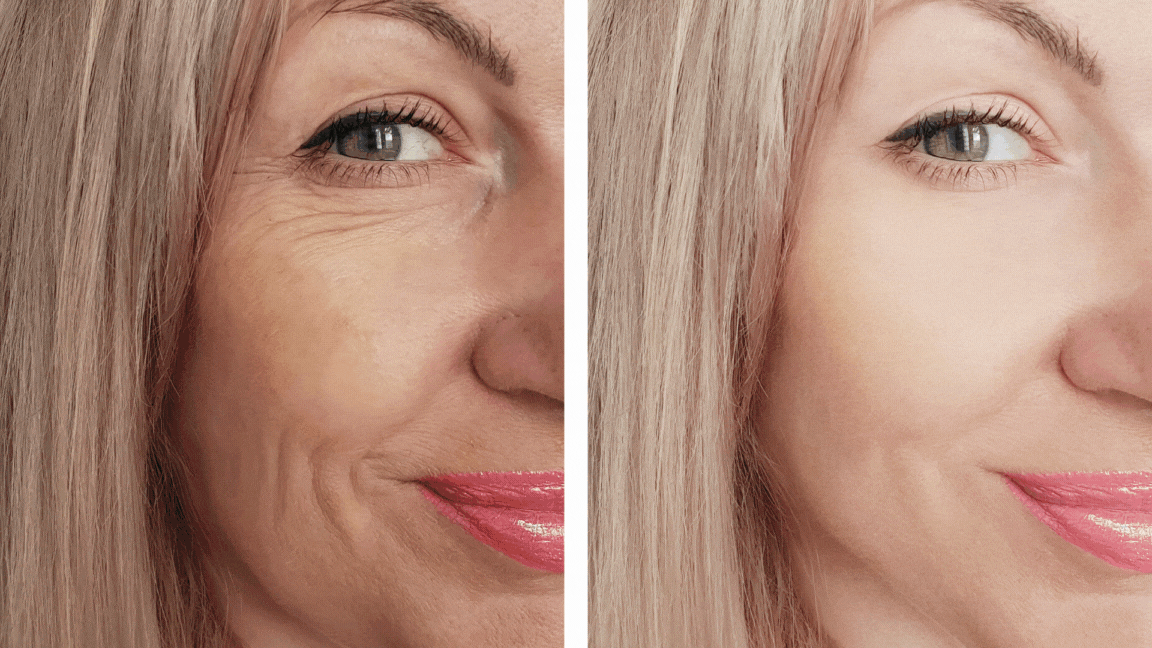 Medspa Services in Columbus, OH, 43215