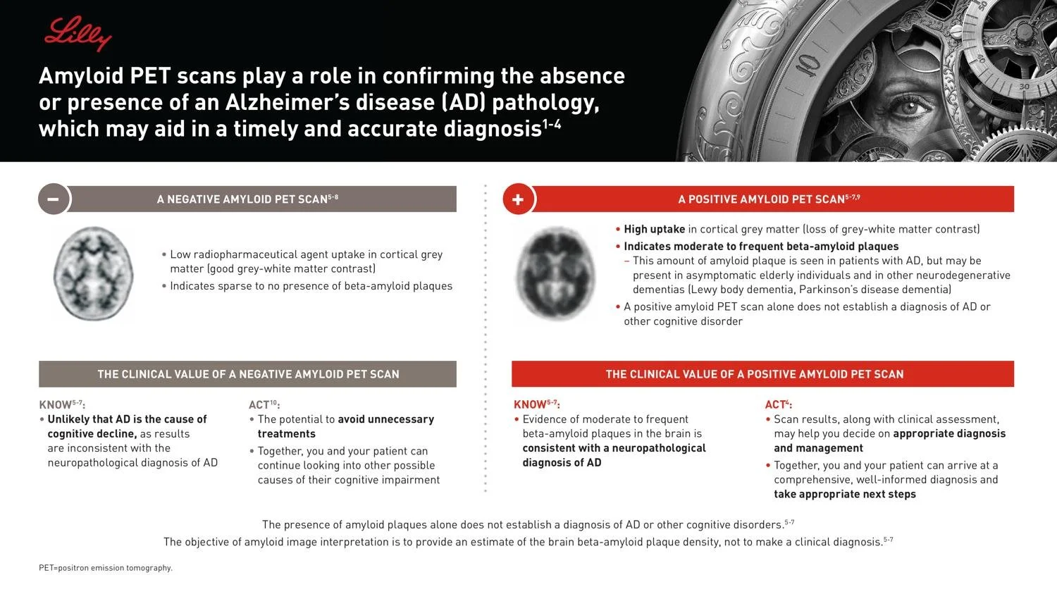 lilly_amyloid_flashcard_squarespace.jpg