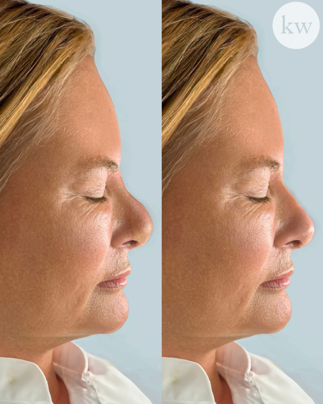 Untitled design 4.PNG