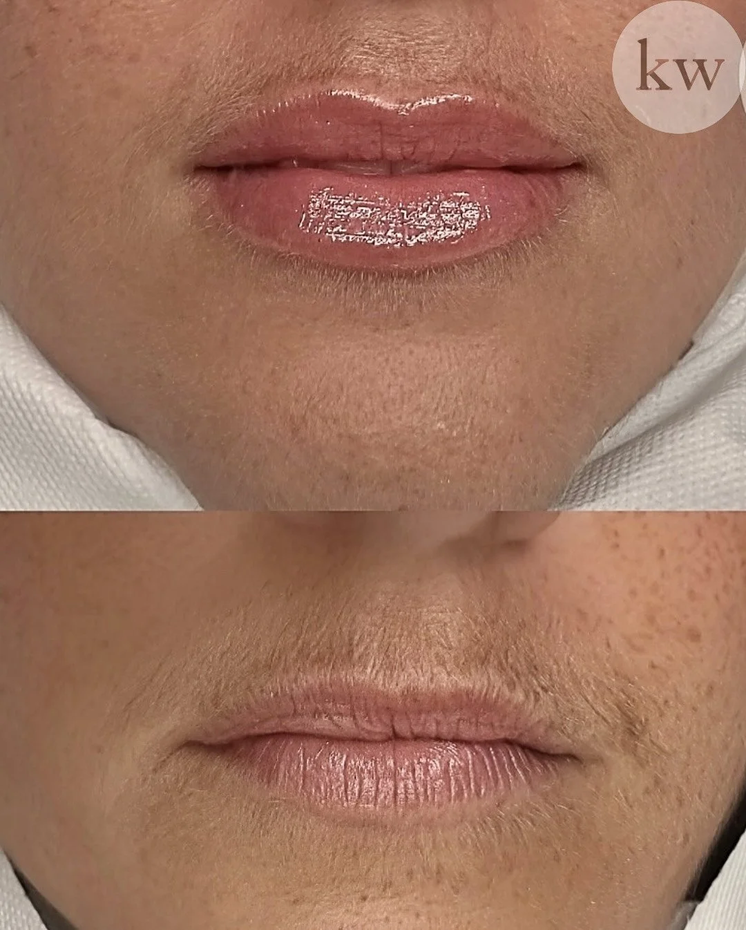 DBA1CF4A-BF62-417F-940B-653BB2F7882F 2.jpg