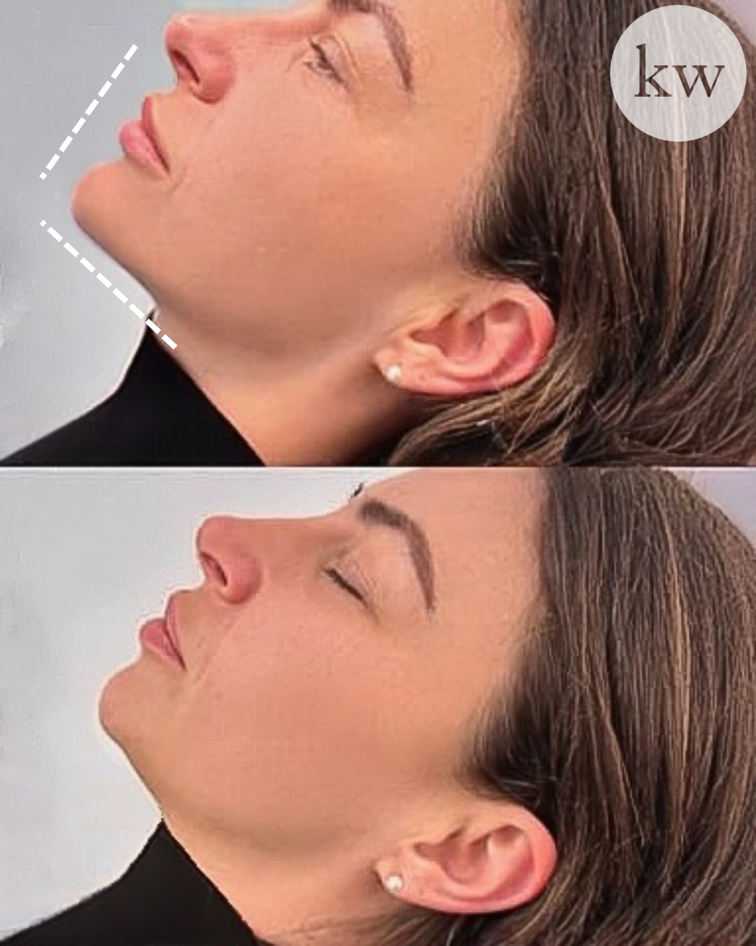 Untitled design 2.png.PNG