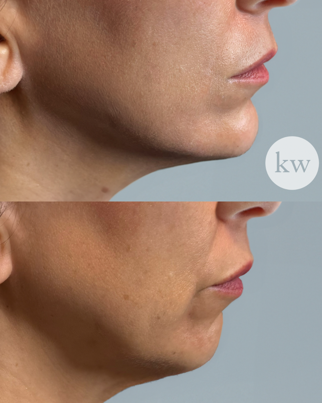 Untitled design 2.PNG