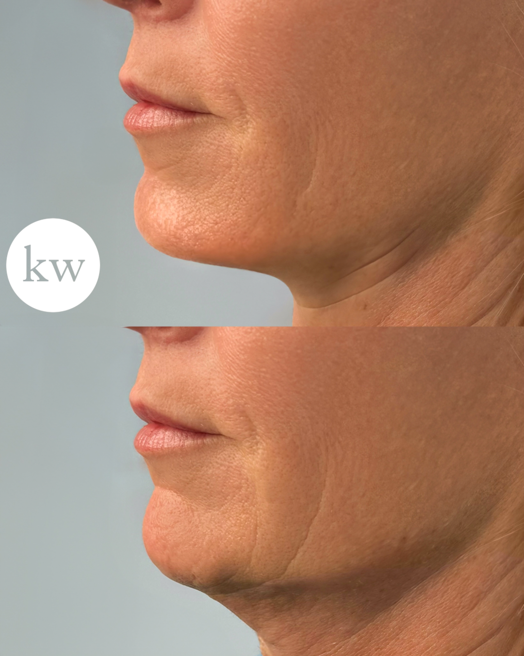 Untitled design 3.PNG