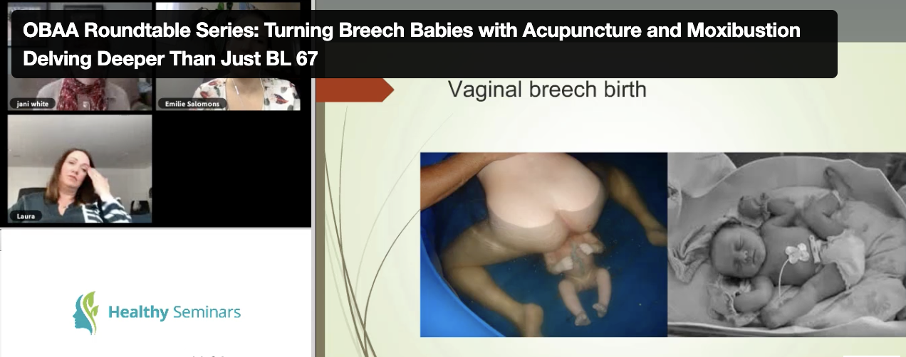 Breech Presentation – Roundtable Discussion