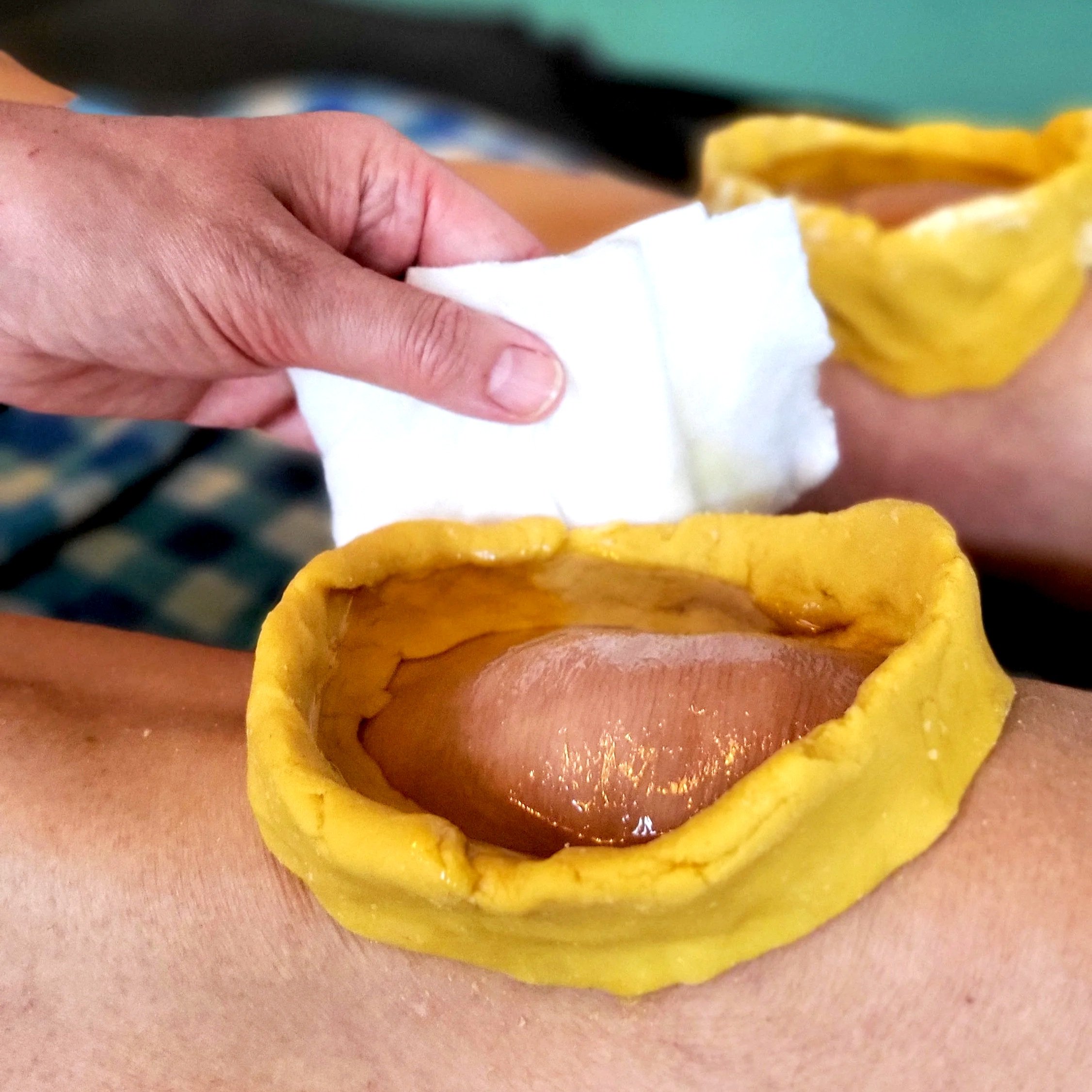 soin basti externe sur les genoux