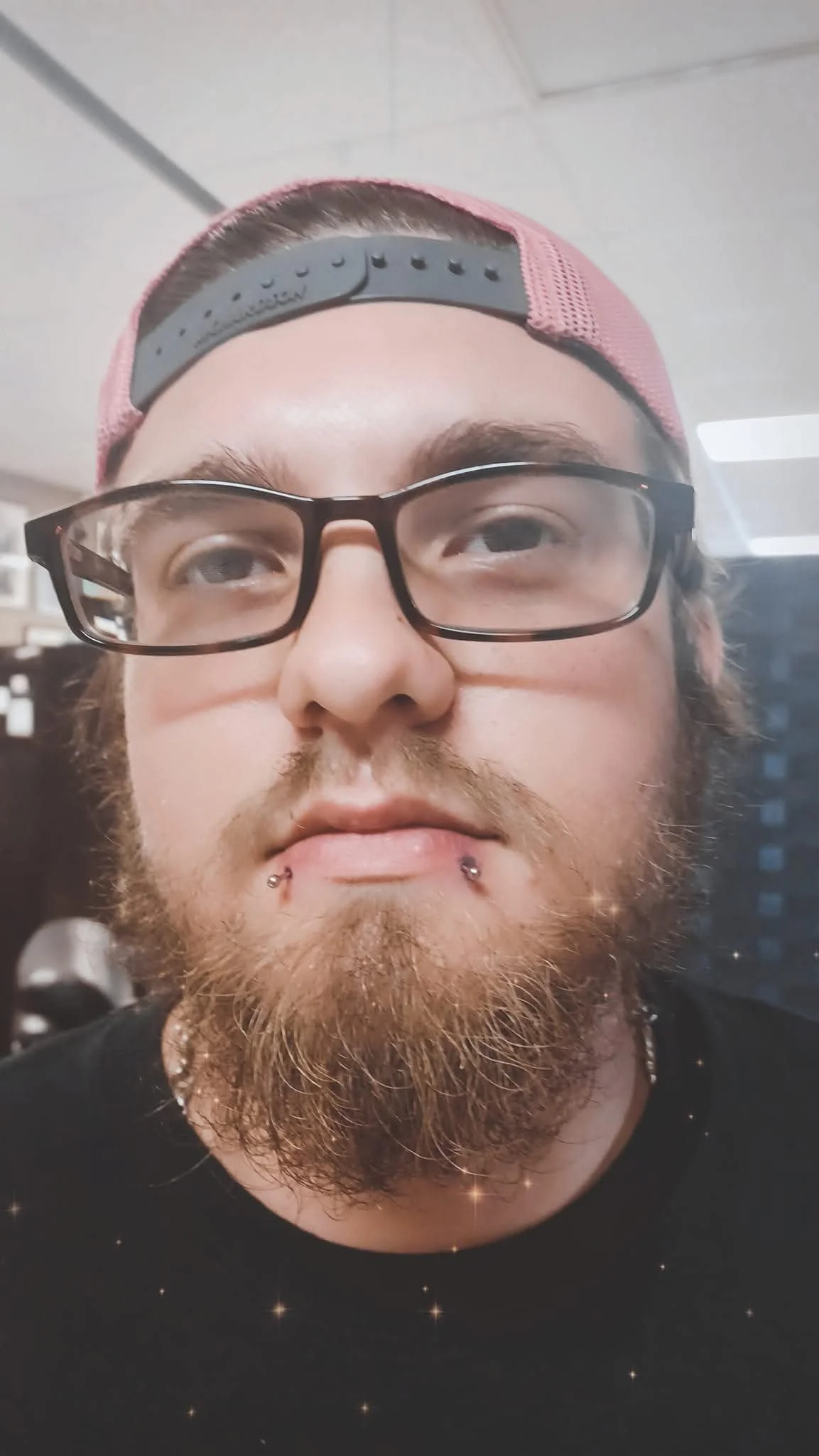 Up-close photo of a man's face with new snake bite piercings.