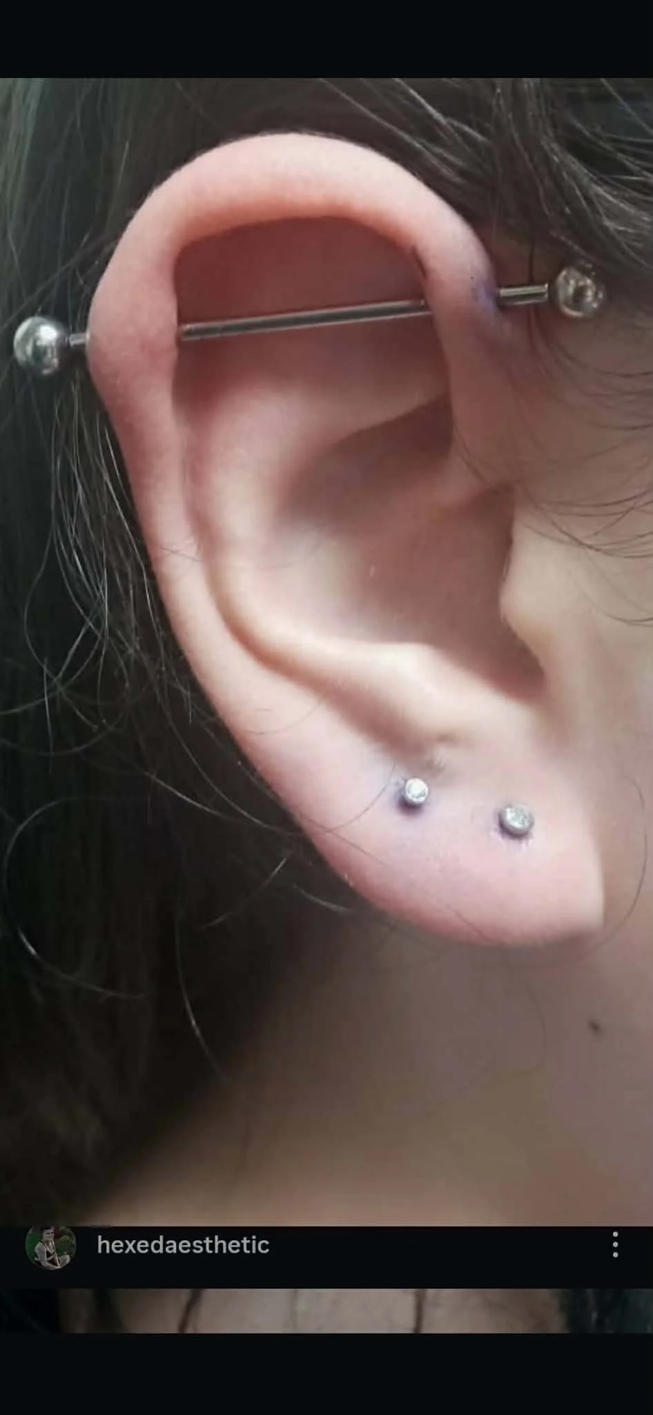 Up-close view of an ear with two lobe piercings.